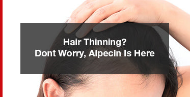 Worried About Your Thinning Hair? Almost Gone Bald?